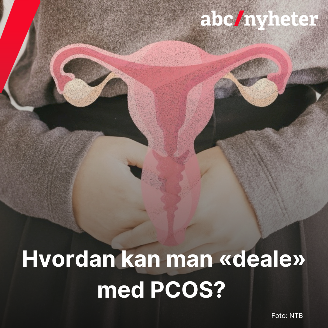 PCOS